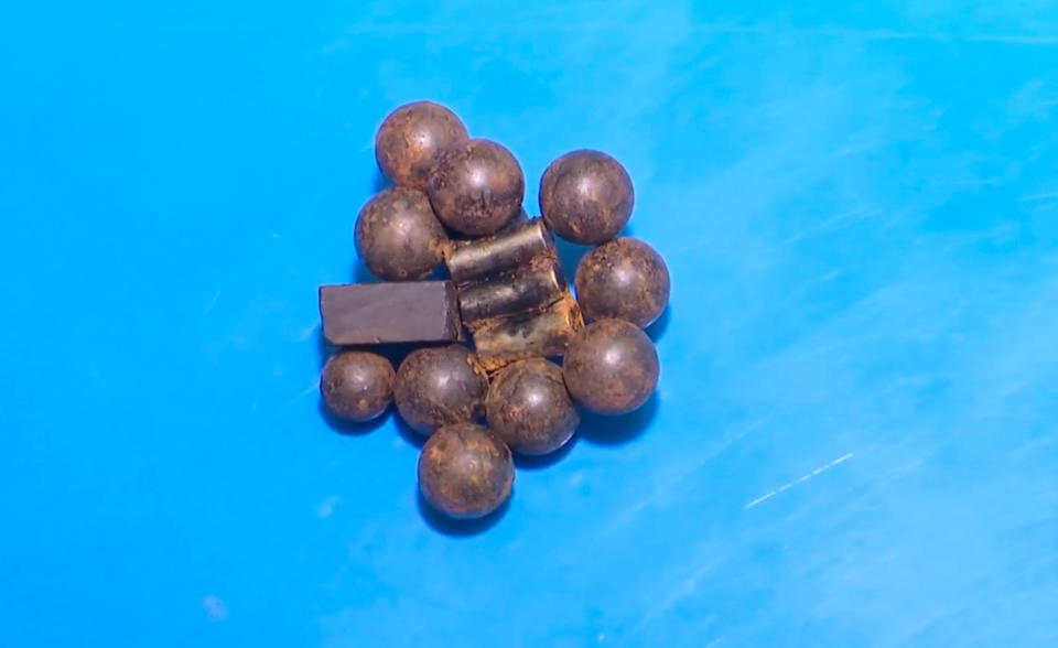 The cluster of 11 magnetic balls removed from Yang Zhiyu's stomach.