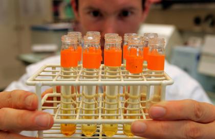 File photo of lab assistant looking at urine tests. (AP Photo/Keystone, Fabrice Coffrini)