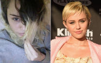 Pixie-Cut, Braids, lange Mähne, Undercut, Blondierungen – Miley Cyrus ist ein echtes Frisuren-Chamäleon. Nun aber will sie zu ihrer braunen Naturfarbe zurückkehren und sich die Haare wieder wachsen lassen – gerüchteweise, weil Liam Hemsworth seine Miley so besonders liebreizend findet. Doch aller Anfang ist schwer: Gegen unschöne Übergangsphasen ist selbst im Fall von Popstars bislang noch kein Kraut gewachsen! (Bilder: Instagram/mileycyrus, Getty Images)