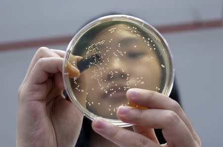 A researcher counts Lactobacillus colonies forming in a petri dish at Otemchi Biotechnology's laboratory in Singapore April 24, 2015. REUTERS/Edgar Su