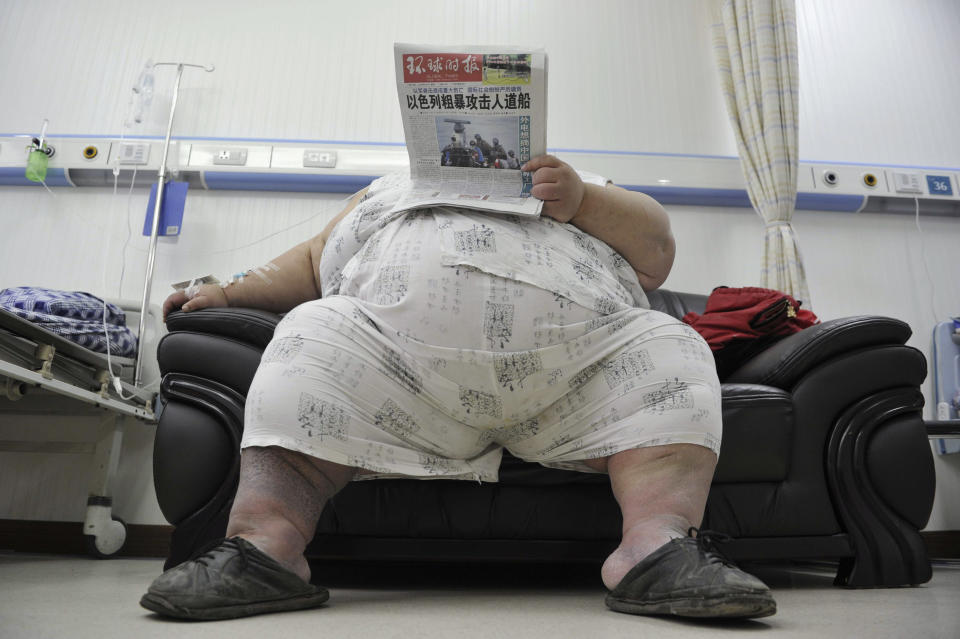 Liang Yong, 30, who weighs about 230 kg (507 lbs) and is 1.58 m (5.18 ft) tall, reads newspaper in a ward at a hospital in Chongqing municipality June 1, 2010. Liang, who has suffered from obesity since 1998 and has unsuccessfully tried different methods of losing weight, is in a critical health condition due to his weight, and has been warded in the intensive care unit since last week, local media reported. REUTERS/Stringer (CHINA - Tags: HEALTH SOCIETY) CHINA OUT. NO COMMERCIAL OR EDITORIAL SALES IN CHINA