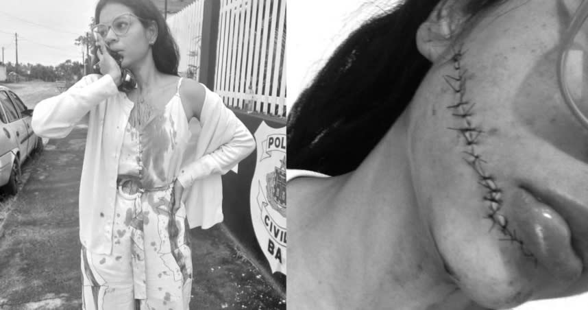 巴西一名女網紅日前搭乘夜間巴士，沒想到在睡覺時竟遭一名陌生女子攻擊，用刀直接從她的耳朵至嘴巴劃開，她當場被痛醒。（圖／翻攝IG@teffi_nh）
