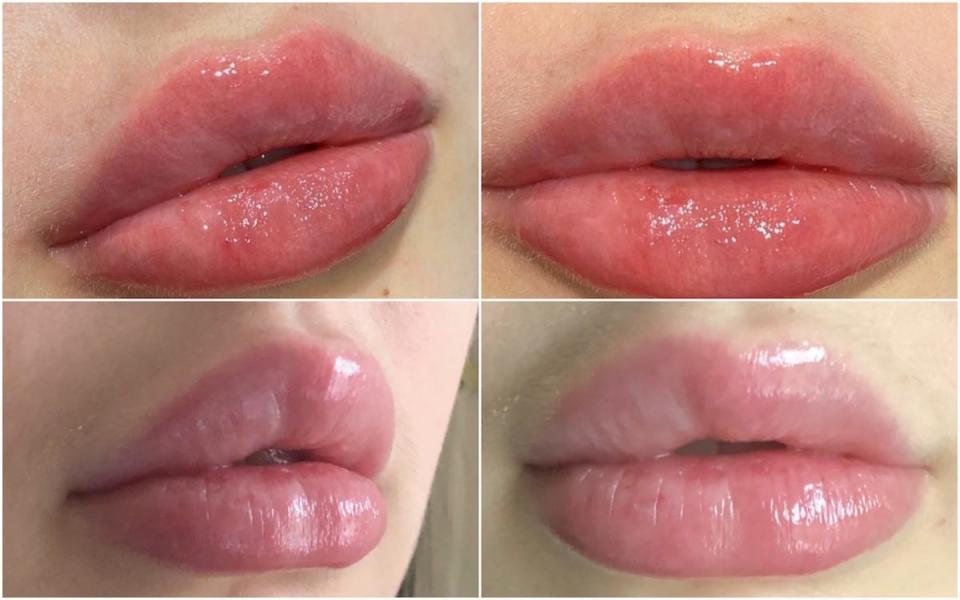 Amy Devese Jenkins lips