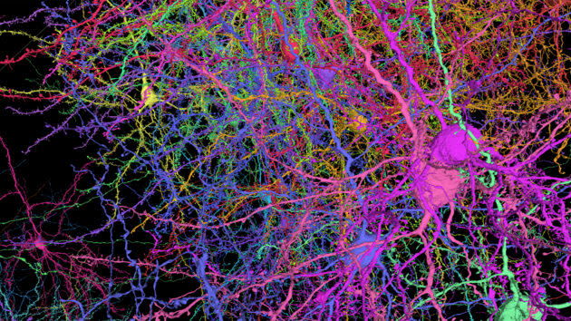 Reconstruction of brain cells