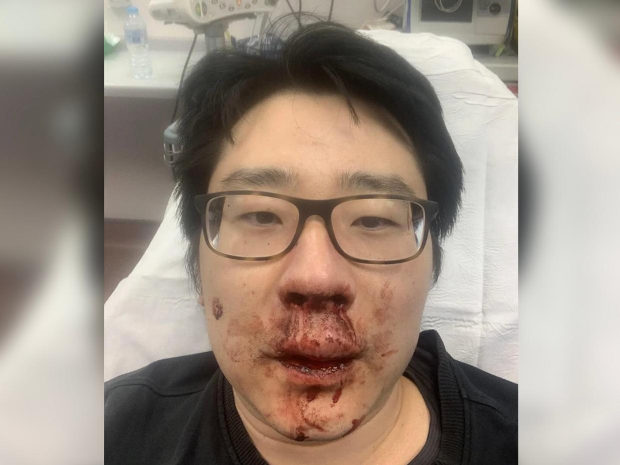 University lecturer Peng Wang, 37, was viciously attacked by four men who shouted racial abuse at him while he was jogging near his home in Southampton (Peng Wang)