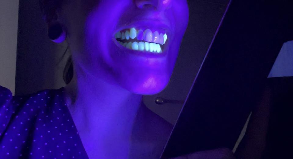 Teeth glowing in the dark