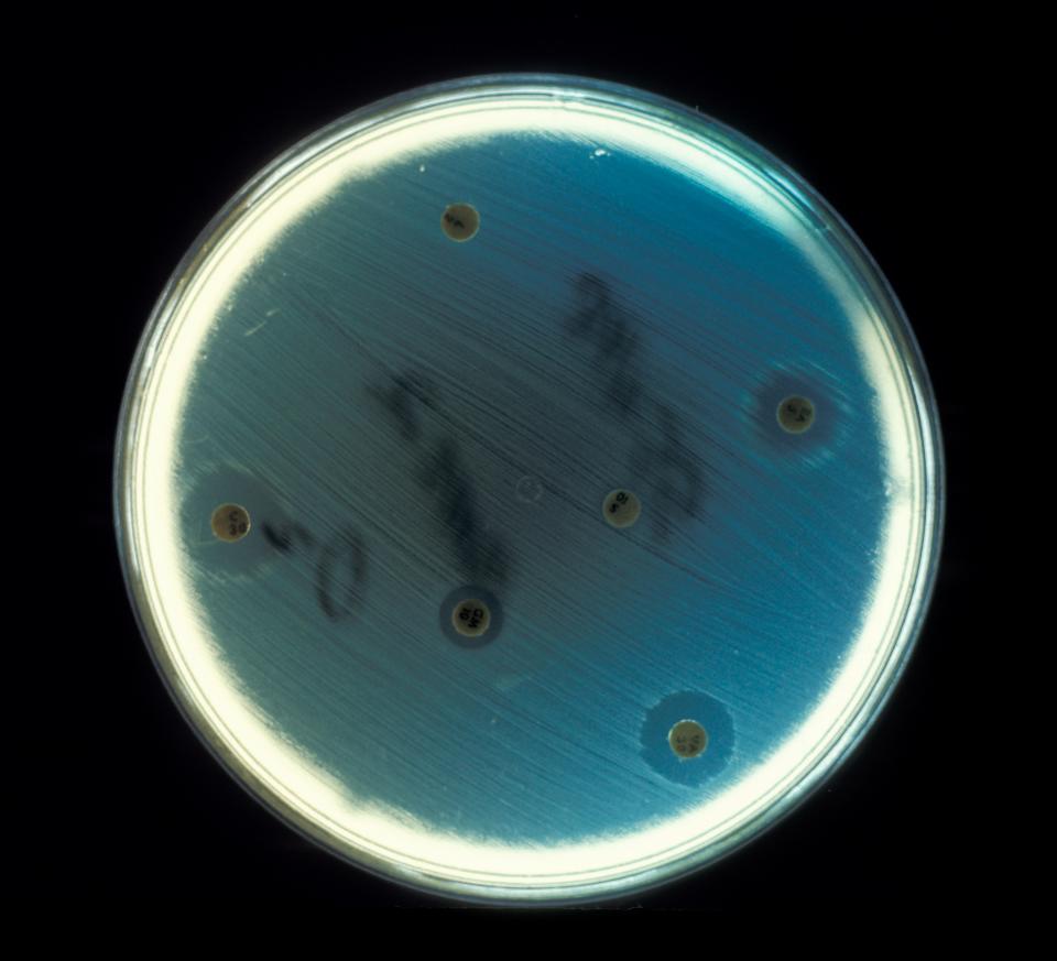 Close-up of enterococcus faecalis on an agar plate