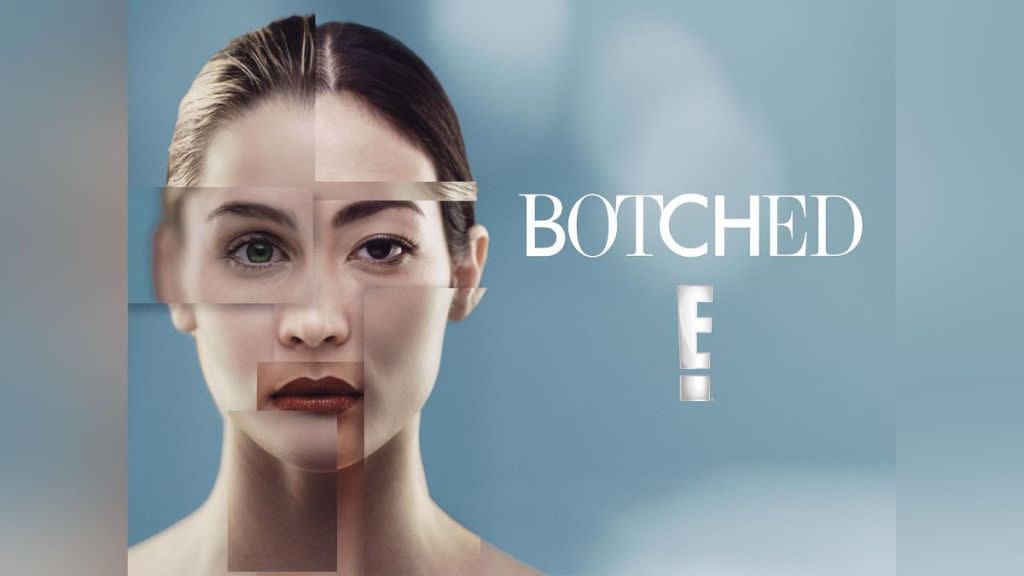 Botched Season 4