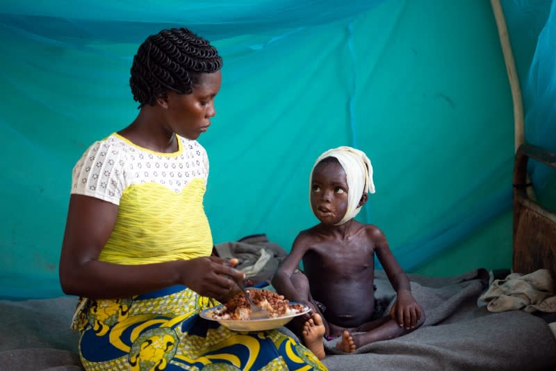 Allay Ngandema, who has developed complications after contracting measles, eats lunch with his mother Maboa Alpha in the measles isolation ward in Boso-Manzi hospital in Mongala province