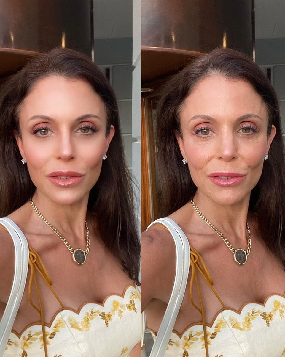 Bethenny Frankel Shares Another Before-and-After Photoshopped Picture: ‘Outright Lying’