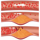 <div class="caption-credit"> Photo by: istockphoto</div><b>Bloodstream</b> Your body releases heat by expanding blood vessels close to the skin's surface (this is why your face gets red during exercise), resulting in more blood flow and more heat dissipated into the air. When you're dehydrated, however, it takes a higher environmental temperature to trigger blood vessels to widen, so you stay hotter.