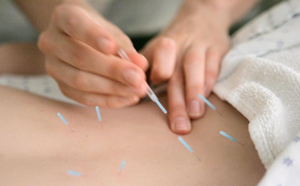 Dashdorj Bayasgalan offered acupuncture-like treatments at his home in Montreal's Notre-Dame-de-Grace neighborhood.  (Stock photo by M. Spencer Green/Associated Press - image credit)