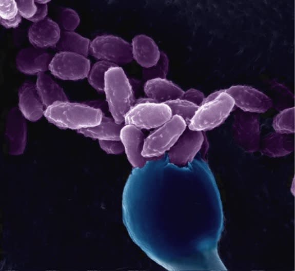 Scanning electron micrograph of infectious yeast spores (purple) on the surface of the structure where they are produced following sexual reproduction (in blue, the basidium).