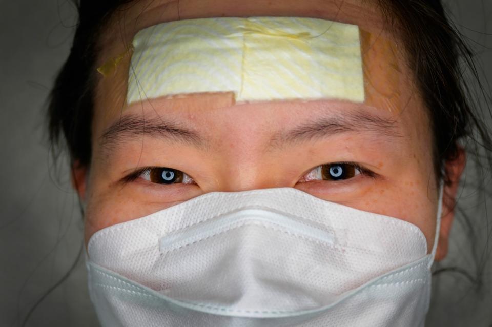 SOUTH KOREA: Nurse Kim Eun-hee, her forehead cushioned with bandages to prevent chafing from her protective face shield, takes a break between shifts caring for COVID-19 patients in Daegu on March 12.