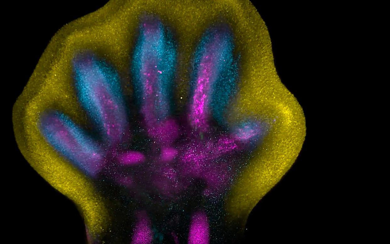 Fingers are sculpted from a blob of cells in the womb rather than growing out of five stumps, a study has found