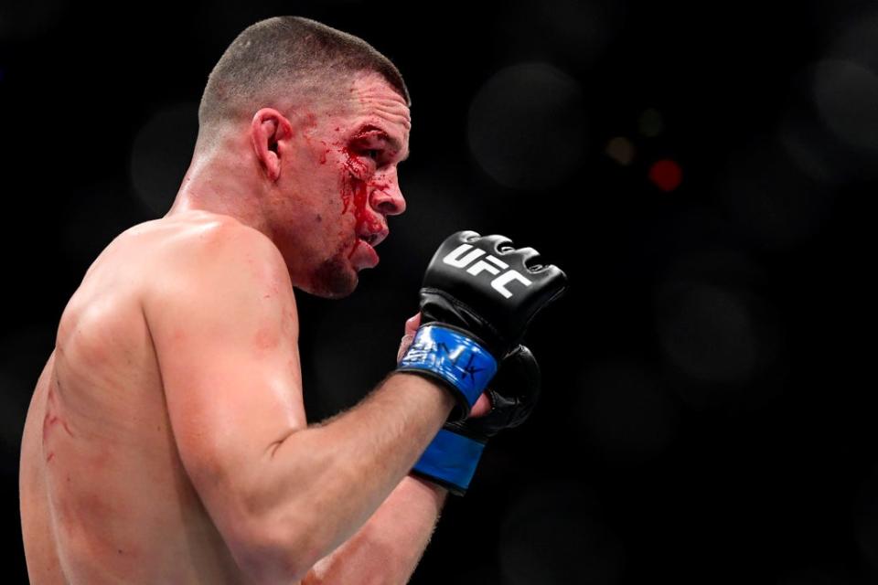 Nate Diaz last fought in November 2019, losing to Jorge Masvidal via doctor stoppage (Getty Images)