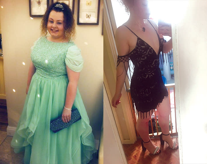 “I felt massive, embarrassed, abnormal, and disgusting.” (Photo: Courtesy of Trinity Wills)