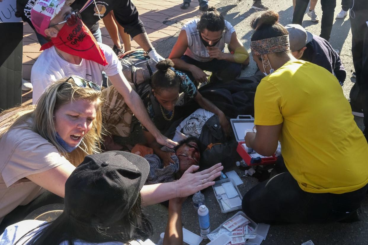 Demonstrators help a man who was sitting on a police car and injured by falling onto the ground during a protest to demand justice for George Floyd in downtown Los Angeles on May 27, 2020. (Ringo H.W. Chiu / AP)
