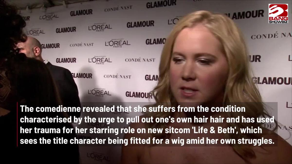 Amy Schumer Has Revealed She Suffers From Trichotillomania 