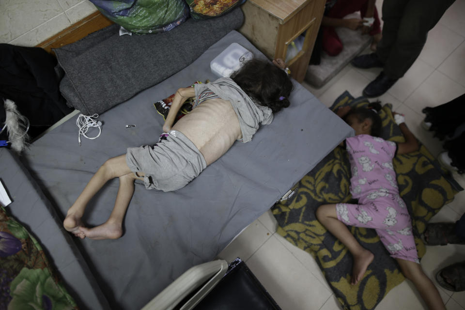 Hana Al-Rai, 3, left, who suffers from diabetes, a weakened immune system and malnutrition, rests at Al-Aqsa Martyrs Hospital in Deir al-Balah in the central Gaza Strip, where she is receiving treatment, Saturday, June 1, 2024. The family is displaced from the northern Gaza Strip. (AP Photo/Jehad Alshrafi)