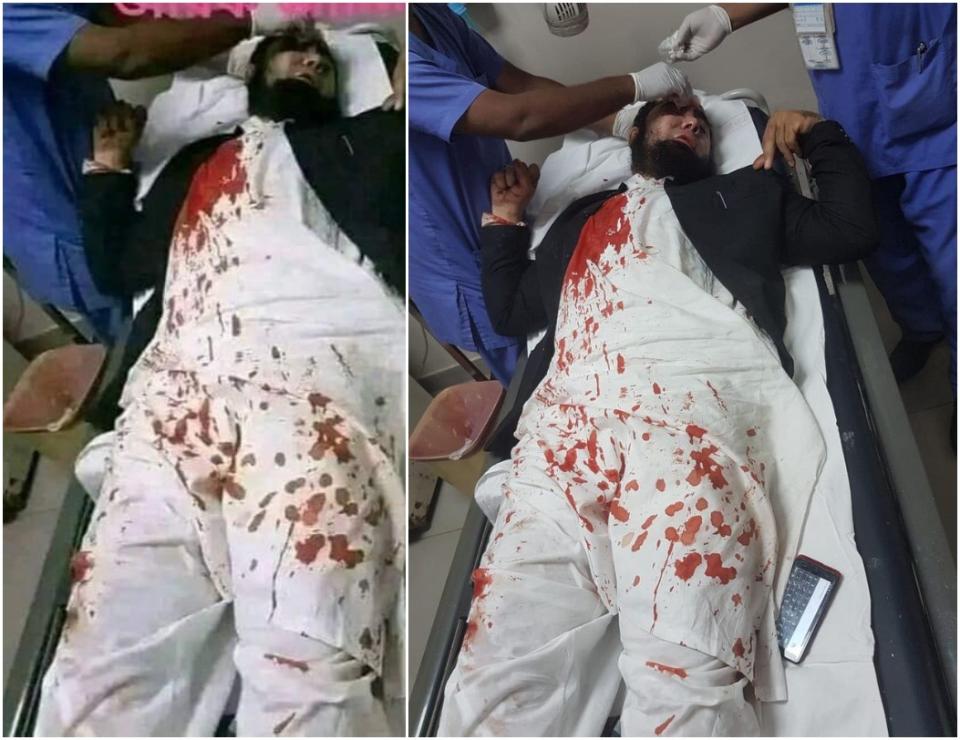 <span>Screenshot comparison of the photo in the false post (left) and the genuine photo from Azad Jameel’s Facebook post (right)</span>