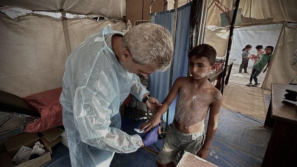 Un sanitario trata a un niño con una enfermedad de la piel.