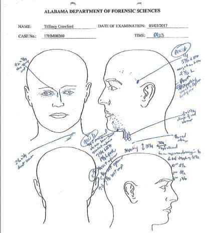 Dr. Green explained that based on the absence of gunpowder particles and abrasions around the left temple wound, she concluded that the shot was fired from at least 10 inches away. 