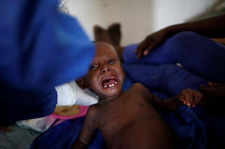 A child is being treated at the cholera treatment center at the hospital after Hurricane Matthew passes in Jeremie, Haiti, October 9, 2016. REUTERS/Carlos Garcia Rawlins