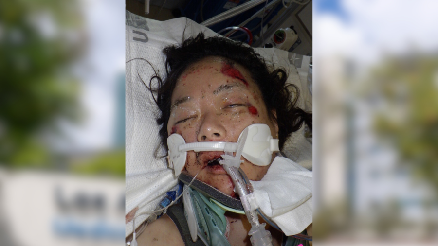 Hospital staff need help identifying an injured female patient in her mid-30s who has been hospitalized since Aug. 16, 2024. (Los Angeles General Medical Center)