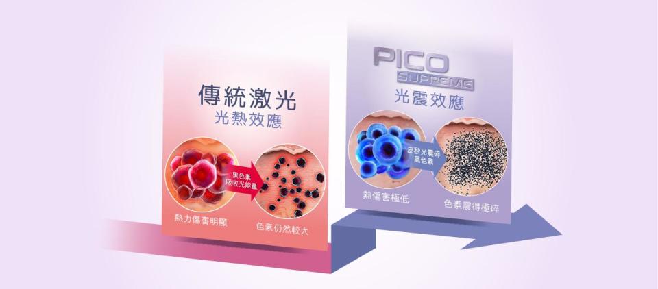 You Medical Beauty PICO Supreme的光震技術可令熱傷害減少，並徹底震碎黑色素更易排出。