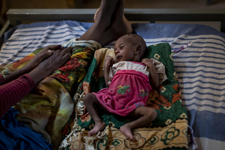 Abeba Gebru, 37, from the village of Getskimilesley, sits with her malnourished daughter, Tigsti Mahderekal, 20 days old, in the treatment tent of a medical clinic in the town of Abi Adi, in the Tigray region of northern Ethiopia, on Tuesday, May 11, 2021. For every mother like Abeba who makes it out, hundreds, possibly thousands, are trapped behind the front lines or military roadblocks in rural areas. (AP Photo/Ben Curtis)