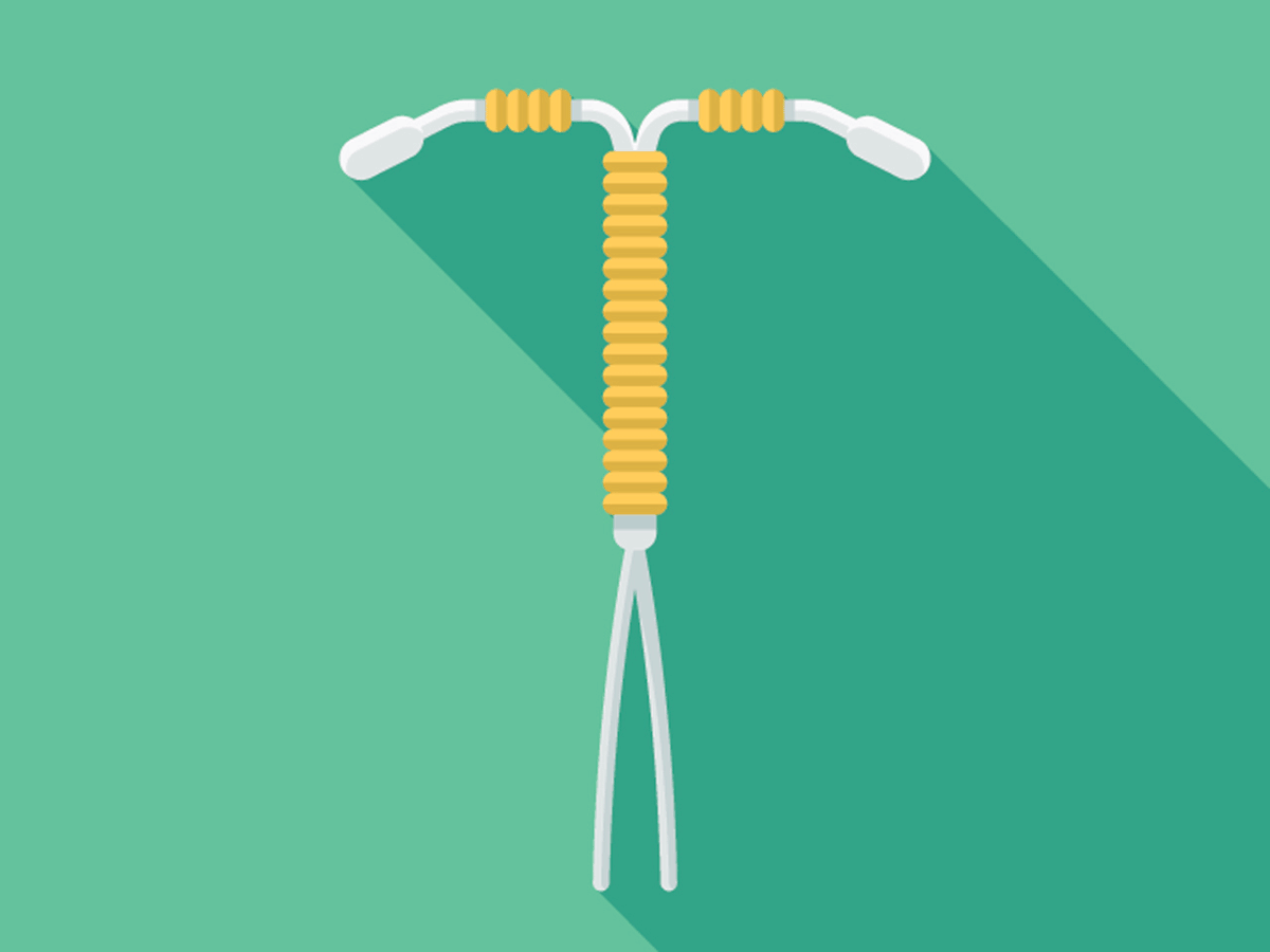 Can My IUD Fall Out if I Have Rough Sex?