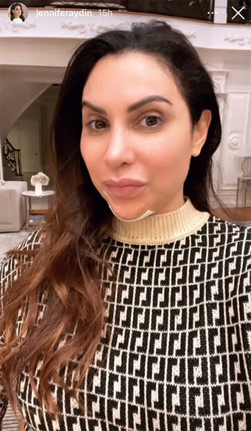 Style Living Ig Rhonj Jennifer Aydin Chin Implant 1