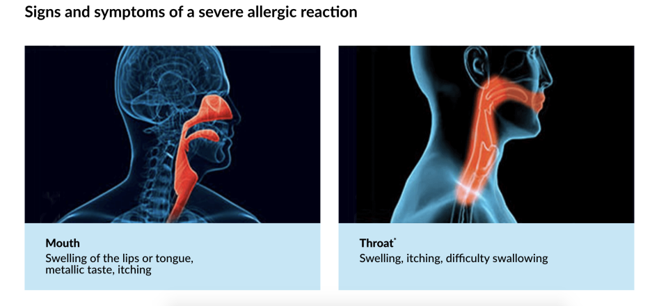 An illustration on the left showing swelling in the mouth and an illustration on the right showing swelling in the throat