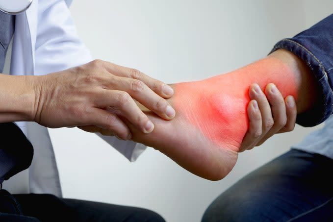 The doctor is pressing the ankle. To see the pain in the treatment of gout, bone disease.