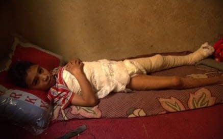 12-year-old Saleh recovering after his home was hit by an airstrike - Haithm Mohsen/Save the Children