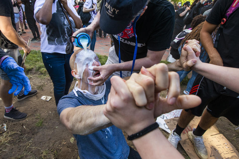 FILE - In this May 31, 2020, file photo, milk is poured into a demonstrator's eyes to neutralize the effect of pepper spray during a rally at Lafayette Park near the White House in Washington. Police deployment of tear gas, pepper spray and chemical agents on protesters has raised concern that the practice may have increased the spread of the coronavirus. (AP Photo/Manuel Balce Ceneta, File)