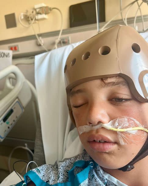 PHOTO: Easton Oliverson, known as 'Tank', a pitcher and outfielder for the Snow Canyon team out of Santa Clara, Utah, suffered an injury from a fall from a bunk bed, recovers from his injuries in Danville, Pa., Aug, 18. 2022. (Oliverson Family)