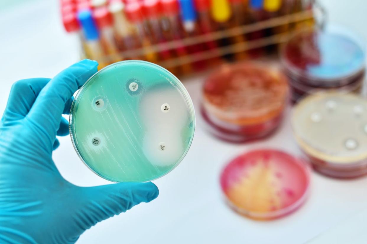 <span class="caption">shutterstock</span> <span class="attribution"><a class="link " href="https://www.shutterstock.com/es/image-photo/antimicrobial-susceptibility-testing-petri-dish-648642895" rel="nofollow noopener" target="_blank" data-ylk="slk:Shutterstock / Jarun Ontakrai;elm:context_link;itc:0;sec:content-canvas">Shutterstock / Jarun Ontakrai</a></span>