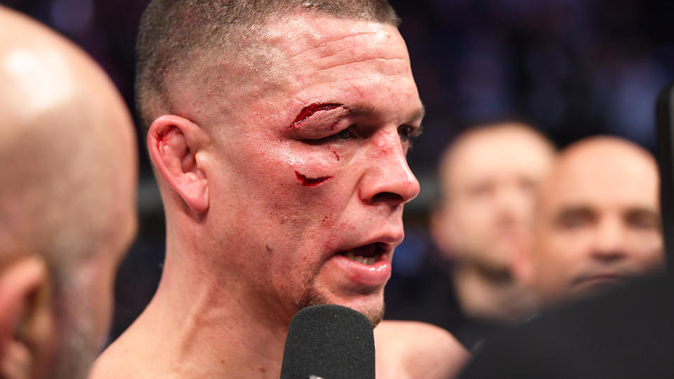 Nate Diaz is interviewed after his loss (doctor's stoppage) to Jorge Masvidal in their welterweight bout for the BMF title during the UFC 244 event at Madison Square Garden. (Photo by Josh Hedges/Zuffa LLC via Getty Images)