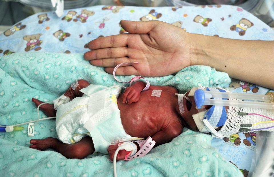 Baby boy the length of a palm is seen inside an incubator in this posed picture taken at a hospital in Xi'an