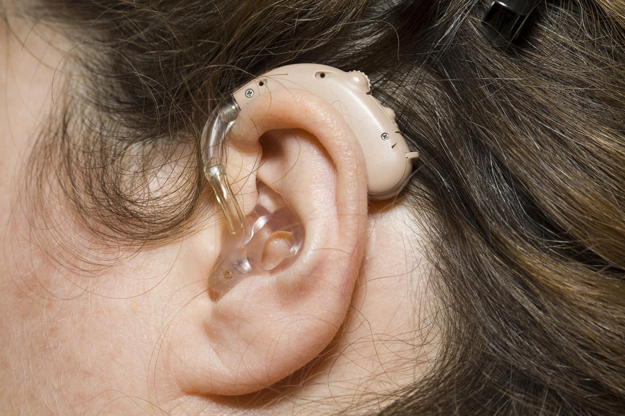 A hearing aid in place on a woman's ear.