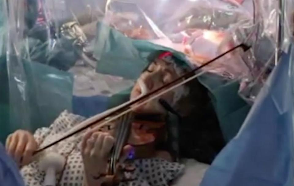 Dagmar Turner plays the violin while British doctors remove a brain tumor.  (Photo: Reuters )