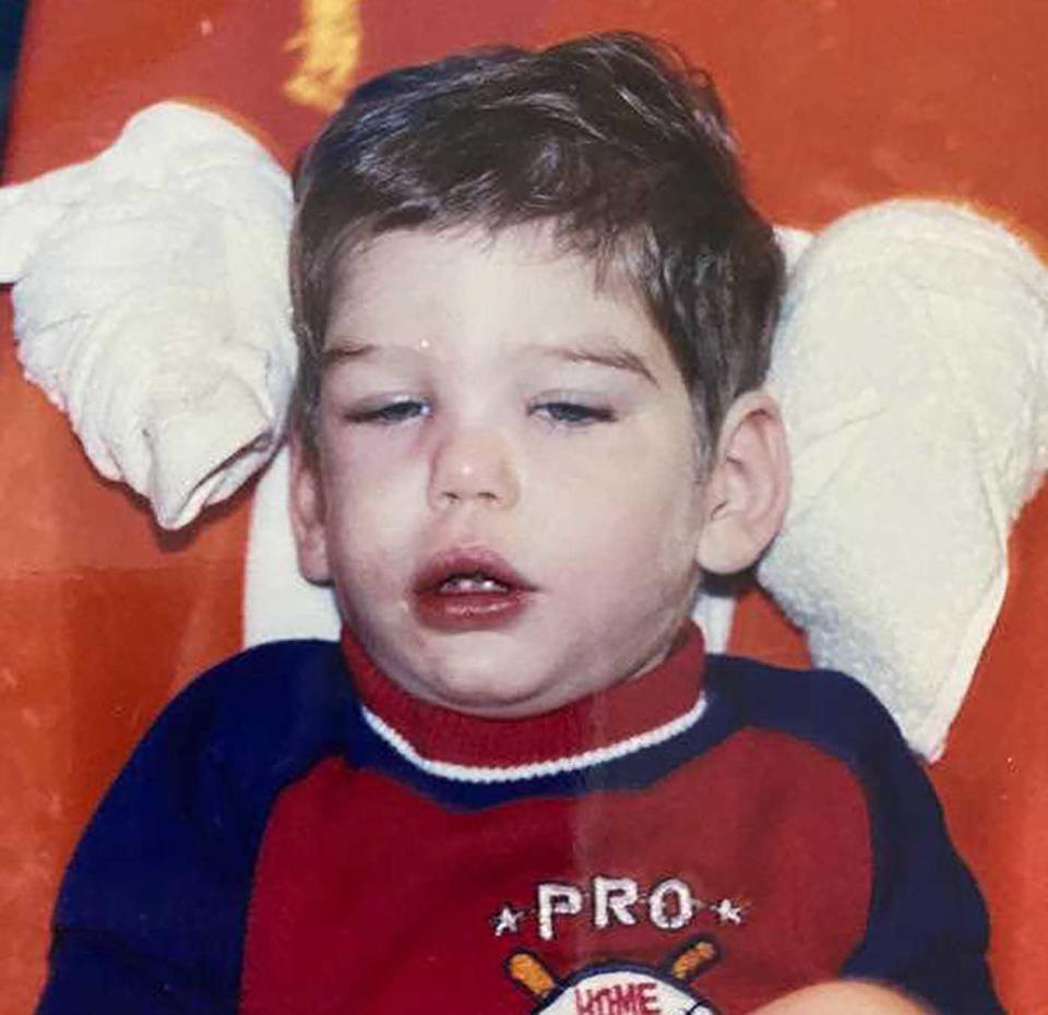 In this undated photo released by the Broward State Attorney's Office, Benjamin Dowling is seen as a toddler after he suffered a 1984 brain hemorrhage that prosecutors say was caused by his babysitter, Terry McKirchy, in Florida..