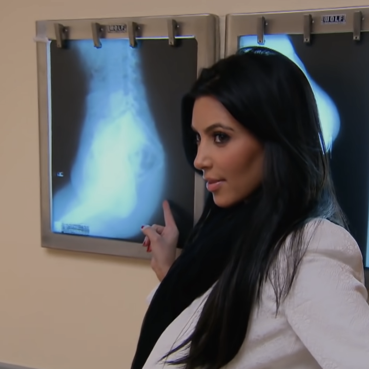 Kim pointing at an X-ray