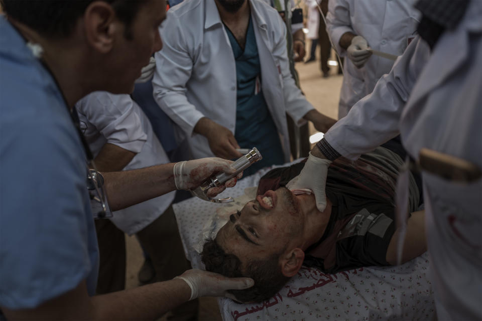 <p>A Palestinian man is treated at the field hospital after being injured by an Israeli sniper during the protest along the Eastern Gaza City’s border with Israel on May 14, 2018. (Photo: Fabio Bucciarelli for Yahoo News) </p>