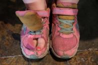 Shannon Winckler from Wheaton, Illinois, sits before her shoes are judged during the Odor-Eater's Rotten Sneaker Contest at Ripley's Believe It or Not! Times Square in New York, U.S., March 28, 2017. REUTERS/Shannon Stapleton