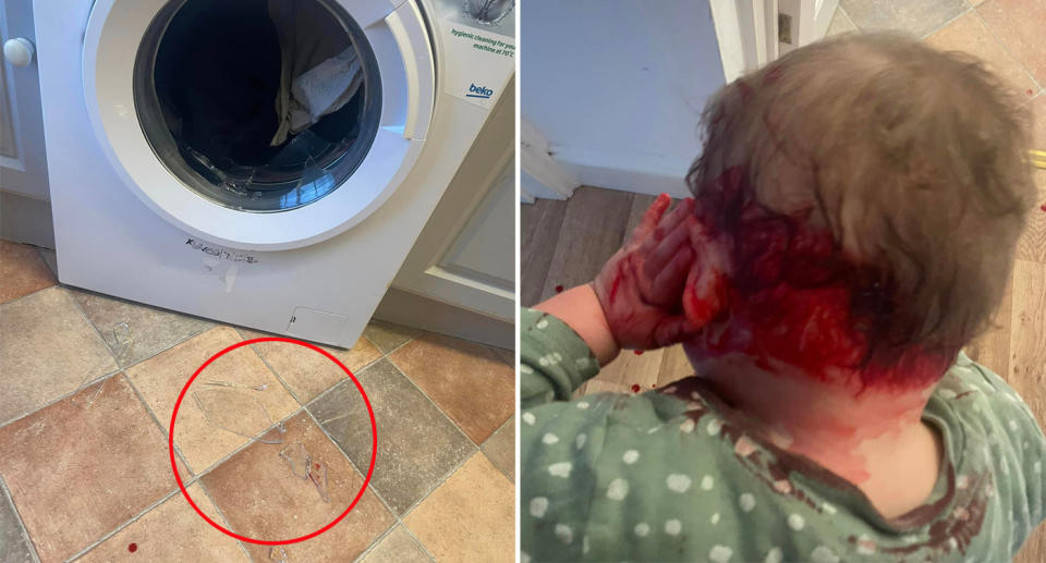 Baby with cuts on his head after glass on Beko washing machine explodes. 