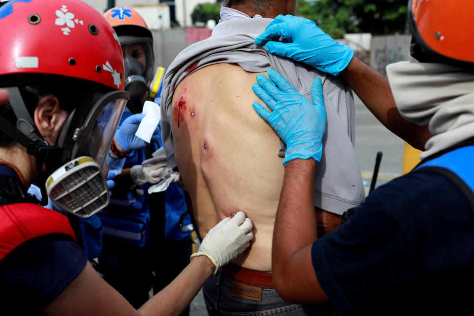 <p>A man receives help after being injured with rubber bullets at a rally during a strike called to protest against Venezuelan President Nicolas Maduro’s government in Caracas, Venezuela, July 27, 2017. (Photo: Marco Bello/Reuters) </p>