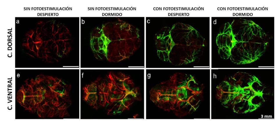 En la imagen se presentan tanto el cerebro desde arriba (fila superior) como desde abajo (fila inferior). Sin fotoestimulación hay mayor señal verde durante el sueño que durante la vigilia. Pero con la fotoestimulación por LED, la señal verde aumentó considerablemente, más durante el sueño que durante la vigilia. <a href="https://opg.optica.org/boe/fulltext.cfm?uri=boe-15-1-44&id=544116" rel="nofollow noopener" target="_blank" data-ylk="slk:Semyachkina-Glushkovskaya et al., Biomed. Opt. Express 15, 44-58 (2024);elm:context_link;itc:0;sec:content-canvas" class="link ">Semyachkina-Glushkovskaya et al., Biomed. Opt. Express 15, 44-58 (2024)</a>